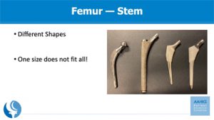 a photo of femur, stem implants